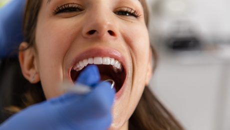 curetaje y limpieza dental