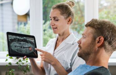 terceros molares impactados terceros molares impactados