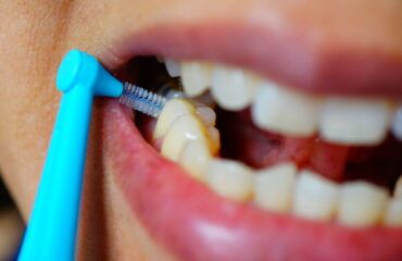 limpieza interdental