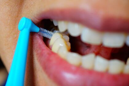 limpieza interdental