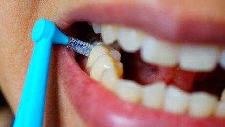 limpieza interdental