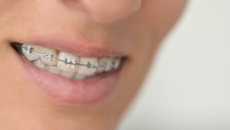 Ortodoncia y salud periodontal